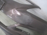 Бампер передний для Hyundai Solaris 2010-2017, OEM 865114L500 - вид 4 (фото)